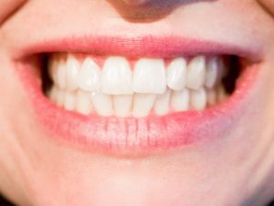 Importância da dentística para a saúde bucal