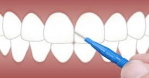 A escova interdental e suas funções
