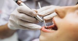 Blindagem coronorradicular e os benefícios no tratamento endodôntico