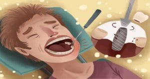 Ilustração de um paciente com a boca aberta e um espelho odontológico dentro dela; ao lado, há uma imagem aumentada de um implante dentário - Má higienização bucal podem ser causadas por doenças peri-implantares