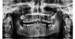 Biotipo facial: por que o dentista deve ter conhecimento sobre isso?
