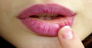 Redução Labial é Possível? Saiba Tudo Sobre Essa Técnica!
